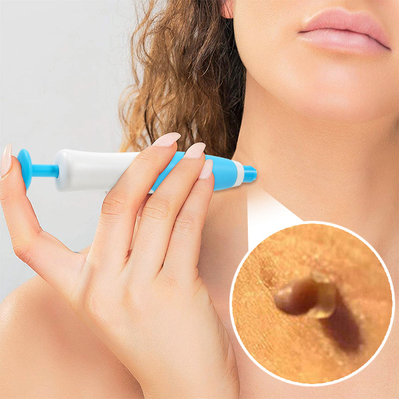 FibrOUT Auto Skin Tag Removal Kit
