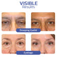 flysmus™ BIGEYES Lifting Eyelid Defining Cream