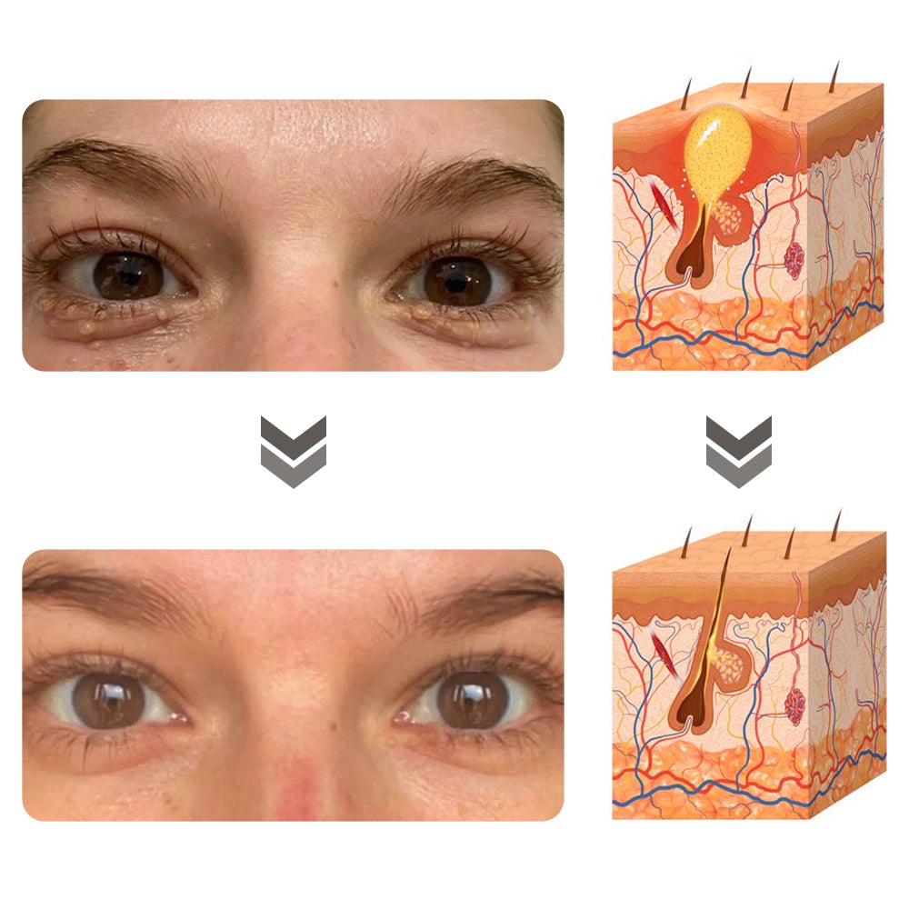 flysmus™ Milkia Spot Removal Lifting Eye Gel