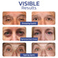flysmus™ RENEWEYES Pigmented Correcting Firming Eye Cream
