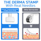 flysmus™ PockmarksNeedling Collagen Derma Stamp