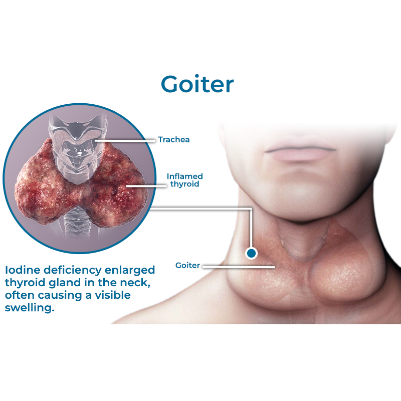 GFOUK™ Neck Goiter and Firming Therapy Serum