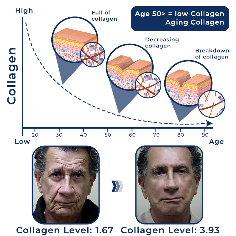 flysmus™ Men's AgeRevive Collagen Cream